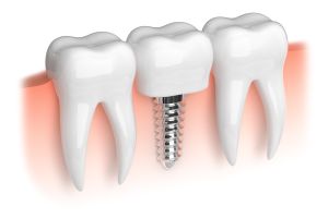 AdobeStock_74379667.jpg