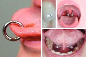 Piercings Behandelbeleid En Traumatische Orale Laesies Tandartspraktijk