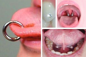 Waarneembaar banaan Vanaf daar Piercings | Behandelbeleid en traumatische orale laesies - TandartsPraktijk