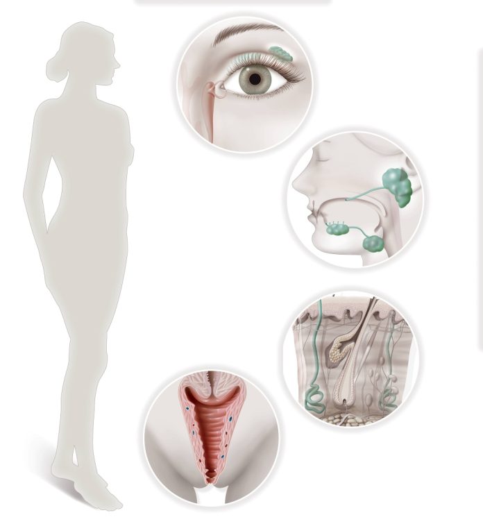SJOGREN'S SYNDROME,ILLUSTRATION