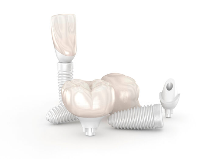 Dental Implants made form ceramic. Dental 3D illustration